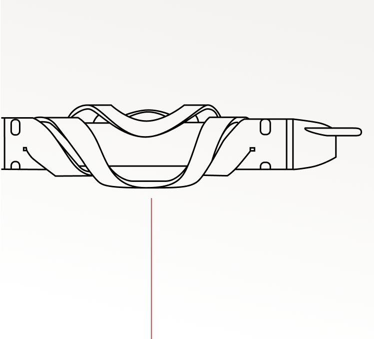 Diagram illustrating the Santreva-ATK's torpedo-shaped tip, which traumatically traverses and compresses plaque laterally against the vessel wall, enabling wire-free intraplaque crossing and one-step vessel preparation.